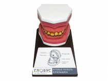 Демонстрационная модель "Ротовая полость курильщика" - «globural.ru» - Краснознаменск